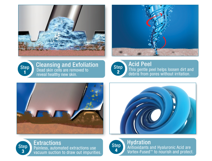 HydraFacial four-step technology explanation