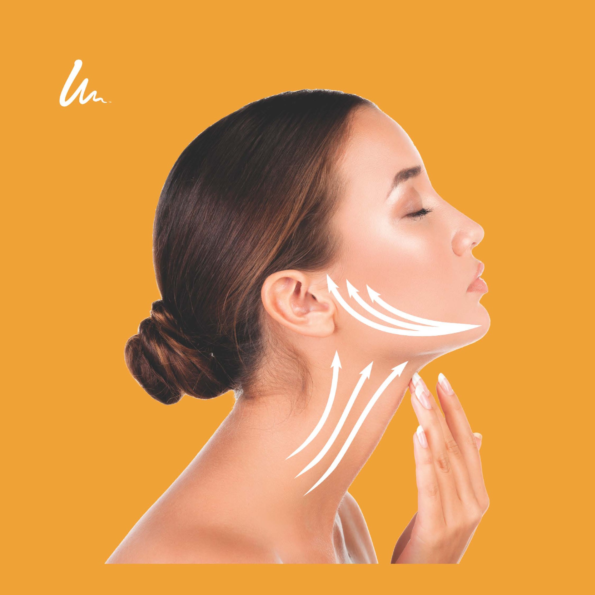 Illustration showing Ultherapy lifting direction for the lower face and neck